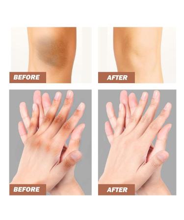2025 New 2pcs 50ml Face Moisturizer Crema Para Manchas Oscuras En La Cara crema Para Las Manchas De La Cara Collagen Cream for Women Adecuado Para Varias reas Como Cara Axilas Cuello Zona Privada - Buy Online on GoSupps.com