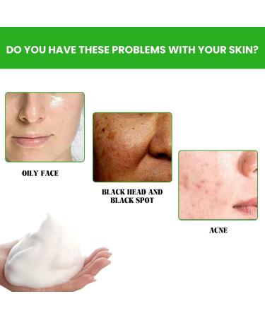 Acne-Fighting Facial Cleanser - Deep Cleanse Remove Oil Dirt Blackheads & Pimples Shrink Pores Refreshing & Comforting(3PCS) - Buy Online on GoSupps.com