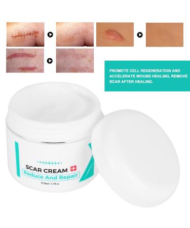 Scar Removal Cream - Pregnancy, Acne, Facial & Skin Repair Treatment Gel - Buy Online on GoSupps.com