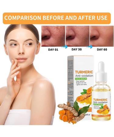 Turmeric Serum Dark Spot Corrector Serum Turmeric Face Serum Skin Corrector Serum Deep hydration Brighten Skin Tone dark spot remover glowing and blemish free skin facial serum for women/Men 30ML - Buy Online on GoSupps.com