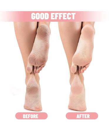 Moisturizing Aloe Vera Gel Spa Socks - 3 Pairs for Dry Cracked Feet - Pink - Buy Online on GoSupps.com