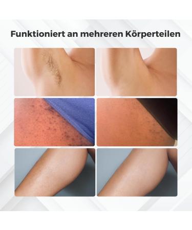 Silkier IPL Laser Hair Removal Device - Permanent Hair Removal 5 Energy Levels Painless & Quick Application for Armpits Body Face & Legs - Buy Online on GoSupps.com