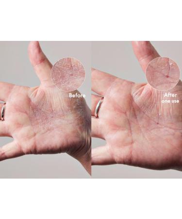 Lanolips Daily Barrier Duo 101 Dry Skin Super Cream (2.02 oz) & Face Base Lanolin & Vitamin E Face Cream (2.02 oz) All-Over & Daily Hydration - Buy Online on GoSupps.com