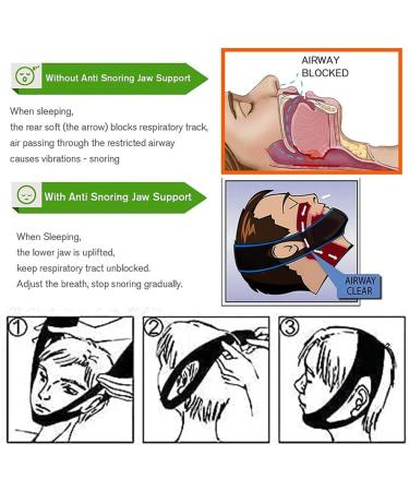 Anti-Snoring Chin Straps - 2 Pack | Snoring Solution for Men & Women | Reduce Snoring Effectively - Buy Online on GoSupps.com