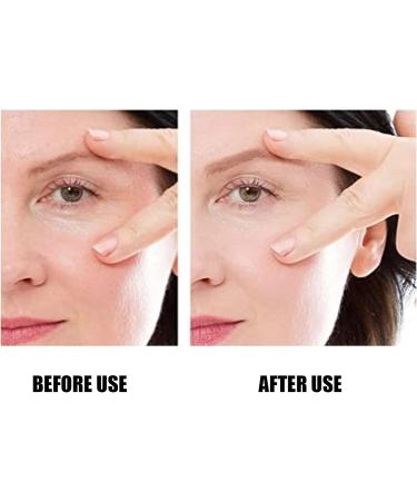 Wrinkle Patch Eliminate Wrinkles Patch Light in Weight Designed To Remove Wrinkles Around the Eyes for Home Use - Buy Online on GoSupps.com