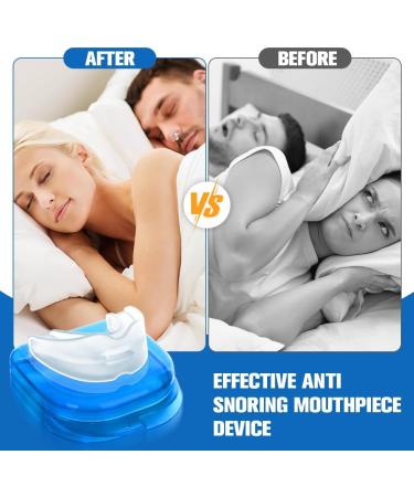 ACWOO Anti Snoring Devices Stop Snoring Devices Effective Snoring Solution Snore Stopper Reusable Stop Snoring Aids Snoring Sleeping Aid Device for Men and Women Restful Night's Sleep - Buy Online on GoSupps.com