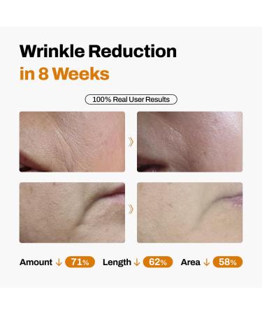 JEU'DEMEURE DermiShuttle Lifting Kit - Anti Aging Serum Face Serum for Firming Anti Wrinkle Skin Elasticity Hydrating with Collagen Peptides Korean Skincare (8 Weeks) 8 Weeks Supply - Buy Online on GoSupps.com