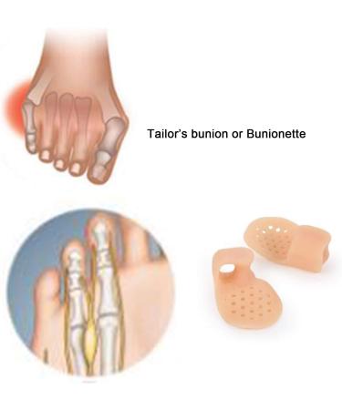 Pinky Toe Gel Cushion Splint | Toe Separators for Men and Women | Prevent Blisters, Corns, and Pain | 5 Pairs-Skin - Buy Online on GoSupps.com