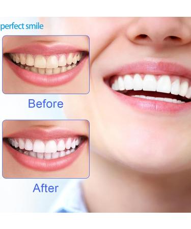 Jiazhou Hub Cosmetic Veneers Teeth Set - 2 Pairs of Dental Teeth for Plug-In Lightening Dentures - Buy Online on GoSupps.com
