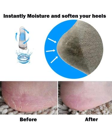 Codream Vented Moisturizing Gel Socks for Dry Cracked Heels - 2 Pairs - Buy Online on GoSupps.com
