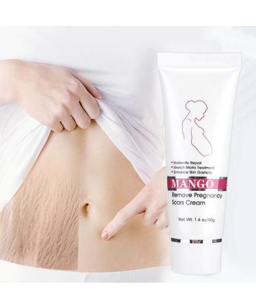 Stretch Mark Cream for Pregnancy & Scars - Maternity Repair & Acne Treatment - Buy Online on GoSupps.com