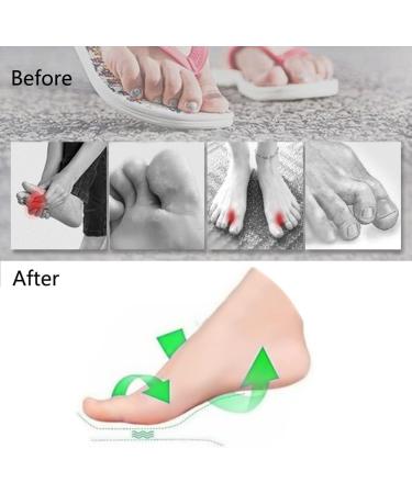 Flip Flop Sandal Gel Inserts - Toe Post Protectors for Comfort and Support - Buy Online on GoSupps.com