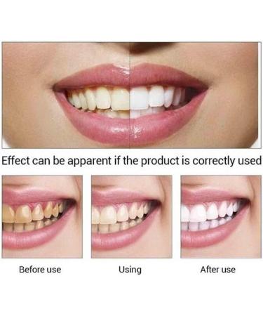 Yanjiayi Bamboo Charcoal Toothpaste - Brightening Activated Carbon Deep Clean | Fresh Breath & Stain Removal | 5-Pack - Buy Online on GoSupps.com