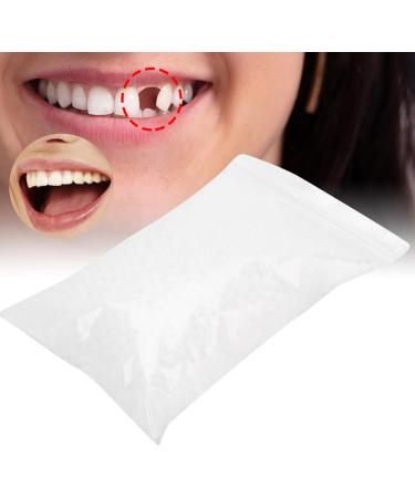 Ververt Touch Temporary Tooth Repair - 100g Filling Material for Broken & Missing Teeth - Fast International Shipping - Buy Online on GoSupps.com