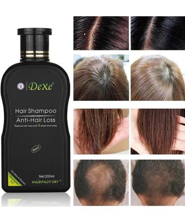 Lucoss Anti-Hair Loss Shampoo Improve Hair Quality Natural Herbal Extract Shampoo Best Hair Growth Shampoo Stimulates Hair Growth Helps Stop Hair Loss Grow Hair Fast Hair Loss Treatment. - Buy Online on GoSupps.com