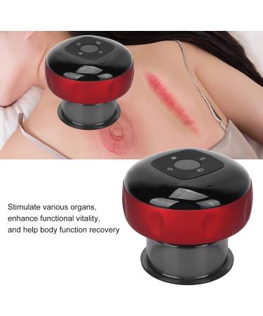 Anggrek Electric Cupping Massager | Professional Smart Therapy Cups | Enhance Recovery & Relaxation - Buy Online on GoSupps.com