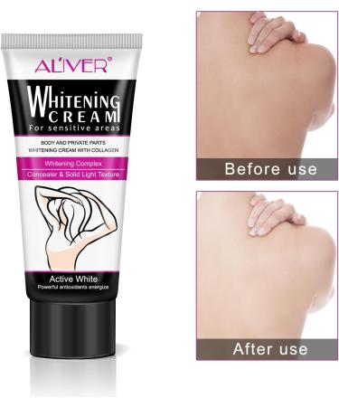 Body Cream Body Whitening Cream Lightening Creamfor Dark Skin Armpit Knees Elbows Private Areas Whitens Nourishes Repairs & Restores Skin - Buy Online on GoSupps.com