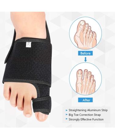 DOACT Bunion Corrector Set for Women - Toe Separator for Bunion Pain Relief - Orthopedic Bunion Splint with Gel Arch Support - Non-Surgical Hallux Valgus Correction - Buy Online on GoSupps.com