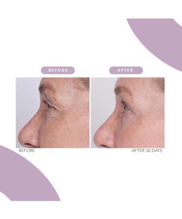 Serious Skincare Reverse Lift Firming Set - 4 Piece Facial Cream Correc-Chin Serum & Eye Cream - Firm Lift & Smooth Wrinkles - Lightweight Formula for All Skin Types - Buy Online on GoSupps.com