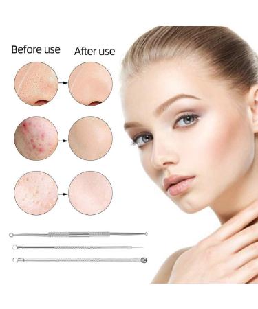 9PCS Blackhead Remover Comedone Extractor Kit with Tweezers and Free Eyebrow Brush - Buy Online on GoSupps.com