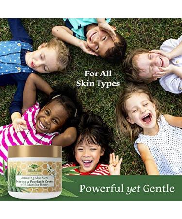 Manuka Honey Eczema Cream - 4oz Moisturizing Lotion for Psoriasis Relief & Itchy Dry Skin - Healing Ointment for Kids, Adults & Babies - Buy Online on GoSupps.com