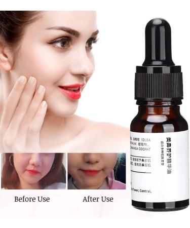 ZJchao Nose Up Essence Oil Magic Nose Shaping & Nasal Bone Remodeling for Instant Lift & Contour | International Shipping Available - Buy Online on GoSupps.com