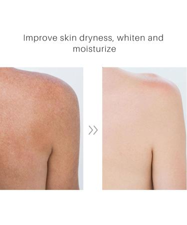  Voiakiu turmeric body cream 100ml ginger extract daily care cream for women moisturiser for smooth skin brightening body lotion for shoulders back neck arms - Buy Online on GoSupps.com