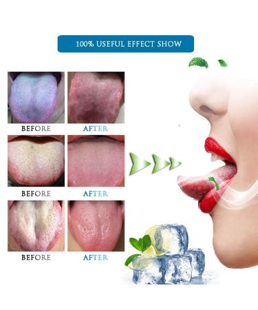 3PCS Soft Silicon Tongue Scraper Set for Effective Bad Breath Cure - Buy Online on GoSupps.com