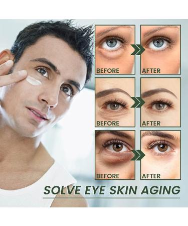 FIOERDTUIE Adults Eye Tightening Cream Nourishing Anti-wrinkle Dark Circle Creams Wrinkle Remover Skin Care Beauty Supplies - Buy Online on GoSupps.com
