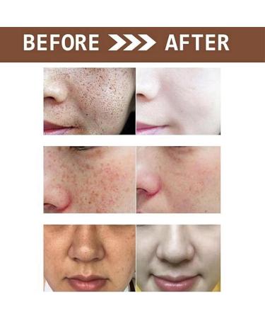 Vitamin C Glutathione Moisturiser For Face Vitamin C Cream Skin Lightening Cream Skin Lightening Cream for Darkskin Skin Lightening Cream Skin Lightening Skin Brightening Film Effective Gentle - Buy Online on GoSupps.com