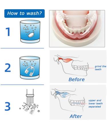 Mouth Guard for Teeth Grinding - 4 Pieces Customized Fit for Bruxism & Snoring No Additives - Buy Online on GoSupps.com