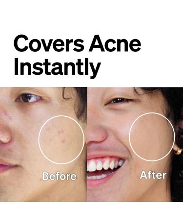 FRONTMAN Fade Skin-Colored Acne Cream for Men - L1 Light Shade 0.33oz - Buy Online on GoSupps.com