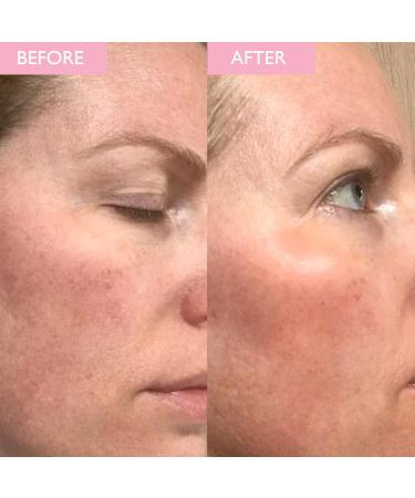 SKINICIAN Revitalising Toner - Hydrating Toner for Brighter Looking Skin - Facial Toner with Soothing Cucumber & Vitamin B5 - Revitalise Skin - Spray Mist Toner - Vegan & Cruelty Free (200ml) - Buy Online on GoSupps.com