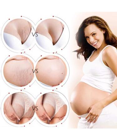 Stretch Marks & Scar Cream for Women | Body Repair Moisturizing Cream - 40g | Effective Post-Pregnancy Skin Care - Buy Online on GoSupps.com