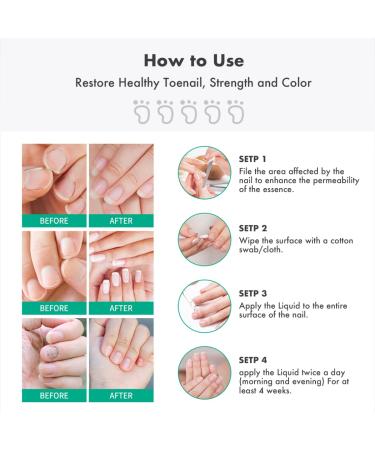 2PCS Kerassentials Toenail Treatment - Extra Strength Formula for Repairing Damaged Nails (30ml) - Buy Online on GoSupps.com