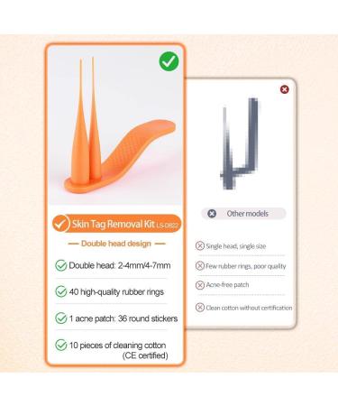 2022 Skin Tag Remover Kit - 2-in-1 Patches for 2mm to 7mm Skin Tags - Mole Wart Tool Device with 40 Remover Bands - Buy Online on GoSupps.com