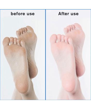 2-in-1 Nano Glass Corn Remover | Wet & Dry Foot Care Tool for Safe & Quick Removal of Dead Skin Calluses & Cracked Heels - Buy Online on GoSupps.com