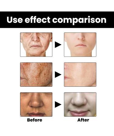 Melanin Correcting Facial Serum | Dark Spot & Vitamin C Serum for Hyperpigmentation Age Spots Melasma - Unisex Solution - Buy Online on GoSupps.com