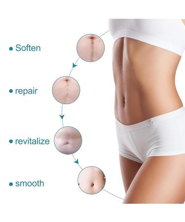 Meinuo Silicone Scar Sheets - Roll Scar Tape for Safe & Painless Scar Removal - 1.6 x 120 - Ideal for Body, Burn, C-Section, Keloid, Acne, Surgery - Buy Online on GoSupps.com