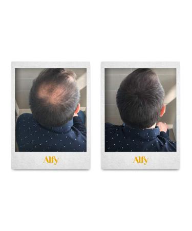 Alfy Hair Building Fibers for Thinning Hair - Dark Brown 12g | Boost Volume & Density - Buy Online on GoSupps.com
