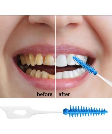 Buy Aynkh Interdental Brushes (200 + 2) Silicone Dental Floss Sticks for Braces Portable Oral Care Tool Fast International Shipping - Buy Online on GoSupps.com