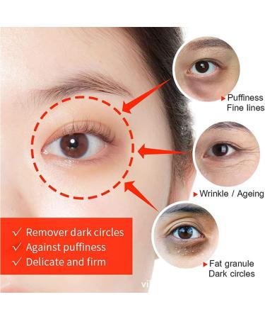 LPSHGK Magic Eye Cream - Instantly Remove Eye Bags, Dark Circles, and Wrinkles in 28 Seconds - Anti-aging Formula - 2PCS - Buy Online on GoSupps.com