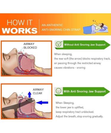 Anti Snore Chin Strap for Men & Women - Improve Sleep & Reduce Mouth Breathing (Pink - Buy Online on GoSupps.com