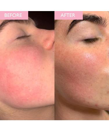SKINICIAN Revitalising Repair Mask - Hydrating Facial Beauty Mask - Calms & Restores Radiance - Soothing Cream Face Mask with Shea Butter - Vegan & Cruelty Free Skincare (50ml) - Buy Online on GoSupps.com