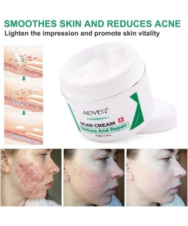 Scar Removal Cream for New Scars - Stretch Mark & Acne Treatment for Face & Body - Buy Online on GoSupps.com