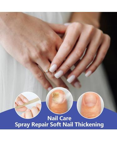 GXGM 1 piece nail care treatment 30 ml nail care serum intensive nail oil for men and women deep care for weakened nails regenerates nail structure repairs cracked and - Buy Online on GoSupps.com