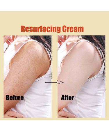 2Pcs strawberry Skin Treatment trawberry Legs Treatment Advanced Triple-Acid Complex Trystrawberry Resurfacing Cream Helps Reduce Chicken Skin Bumps Exfoliating Body Cream With Deep Hydration - Buy Online on GoSupps.com