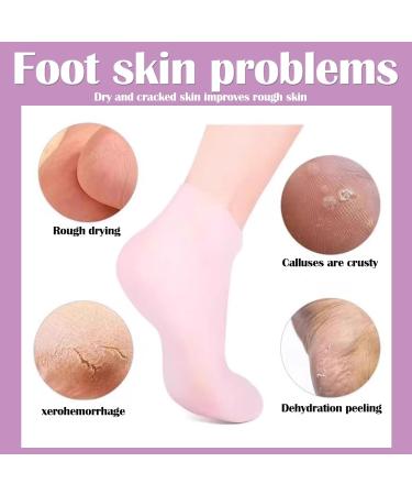 3 Pairs Silicone Socks for Women Silicone Socks for Cracked Feet Women Foot Spa Pedicure Silicone Socks Softening Dry Cracked Feet Rough Skins Protective Gel Socks(Pink) - Buy Online on GoSupps.com