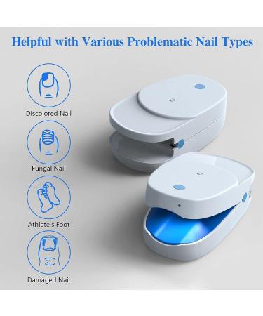Effective Toenail Fungus Laser Remover Device for Onychomycosis Treatment - Nail & Toe Fungal Cleaning Solution - Buy Online on GoSupps.com