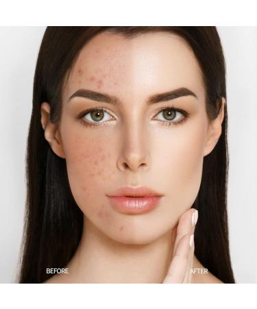 Anglicolor Mushroom Head CC Cream Matte Foundation Concealer - 102 # Nature - Buy Online on GoSupps.com